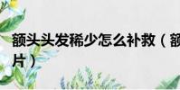額頭頭發稀少怎么補救(額頭頭發稀少發型圖片)