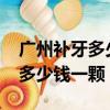 廣州補牙多少錢一顆牙2023（廣州補牙一般多少錢一顆）
