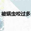 被螨蟲咬過多久能好（被螨蟲咬了多久能好）