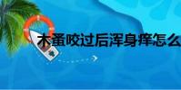 木蚤咬過后渾身癢怎么辦?(木蚤)