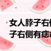 女人脖子右側有痣命好嗎 代表什么（女人脖子右側有痣命好）