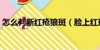 怎么判斷紅瘡狼斑(臉上紅斑最快消除方法)