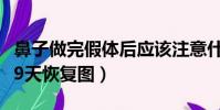 鼻子做完假體后應該注意什么(鼻子做完假體9天恢復圖)